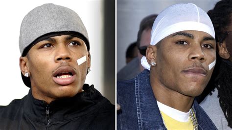 rapper with plaster on face|More.